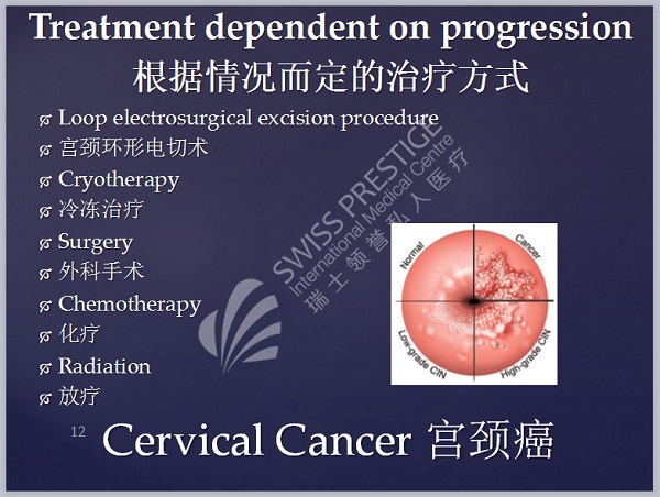 宮頸癌治療方法